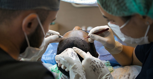Hair restoration specialists in Turkey performing implant surgery on a patient