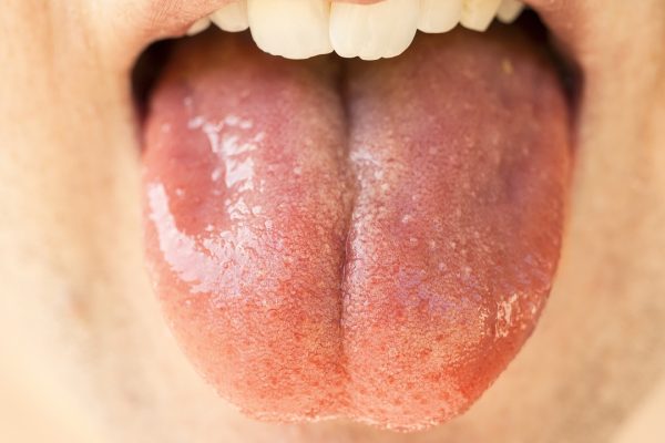 Why Is My Saliva So Thick? Top 8 Reasons Why This Happens